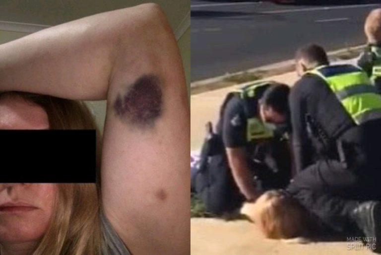 Police State: Victoria Police kneel on white woman’s head