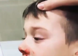 Little boy injured and traumatised by coronavirus test in Australia