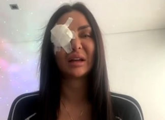 SYDNEY ACID ATTACK: Jenny Elhassan attacked “in the middle of Ramadan”, police baffled