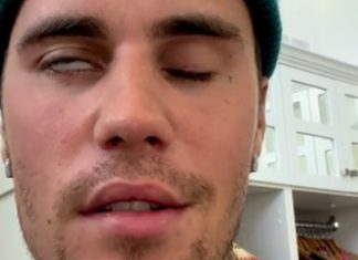 VACCINE CARNAGE: Justine Bieber’s face paralysed